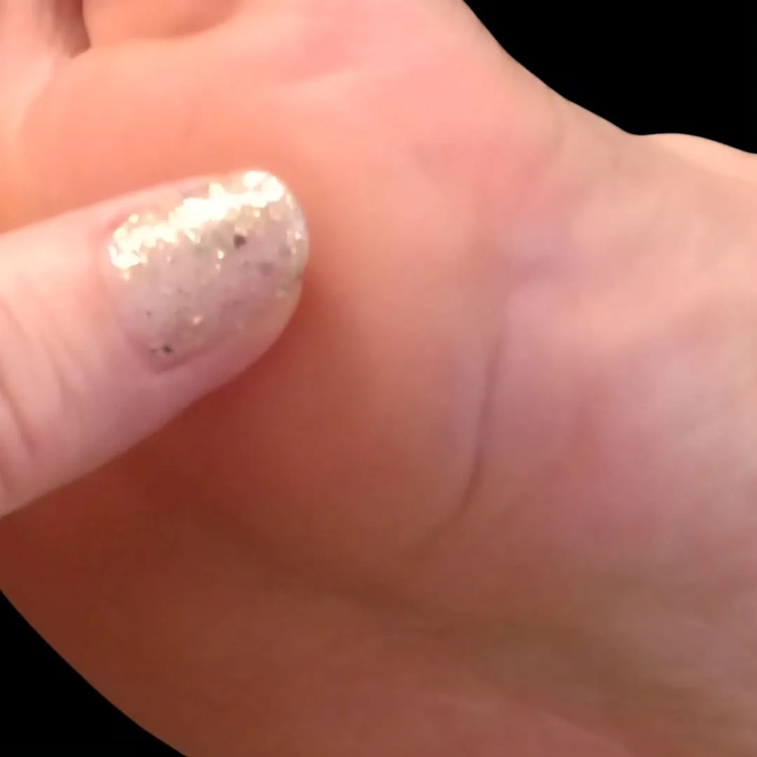 凹足の方は母指球に体重がかかることが多く、余分な角質で肥厚し...