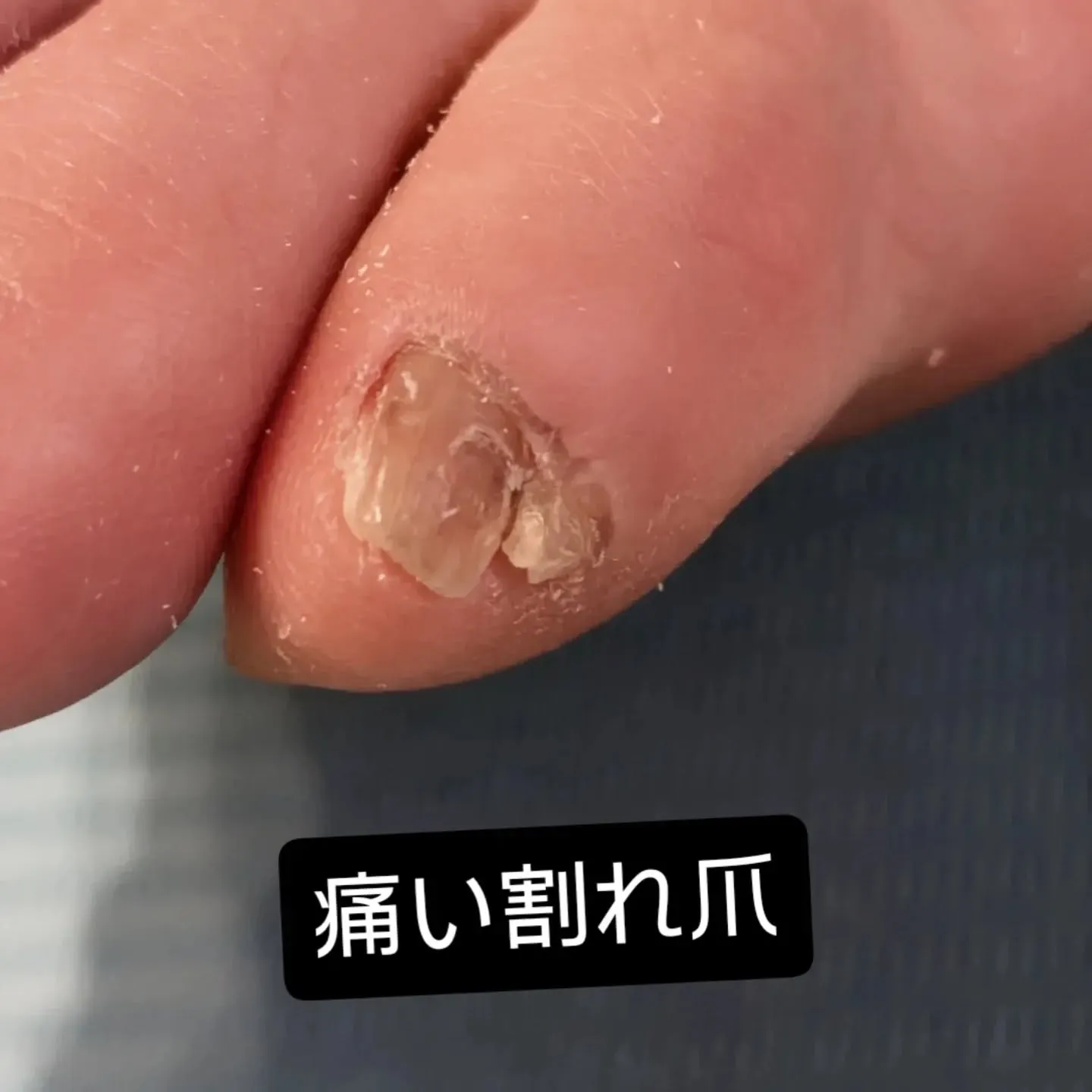 乾燥のきつい季節です。