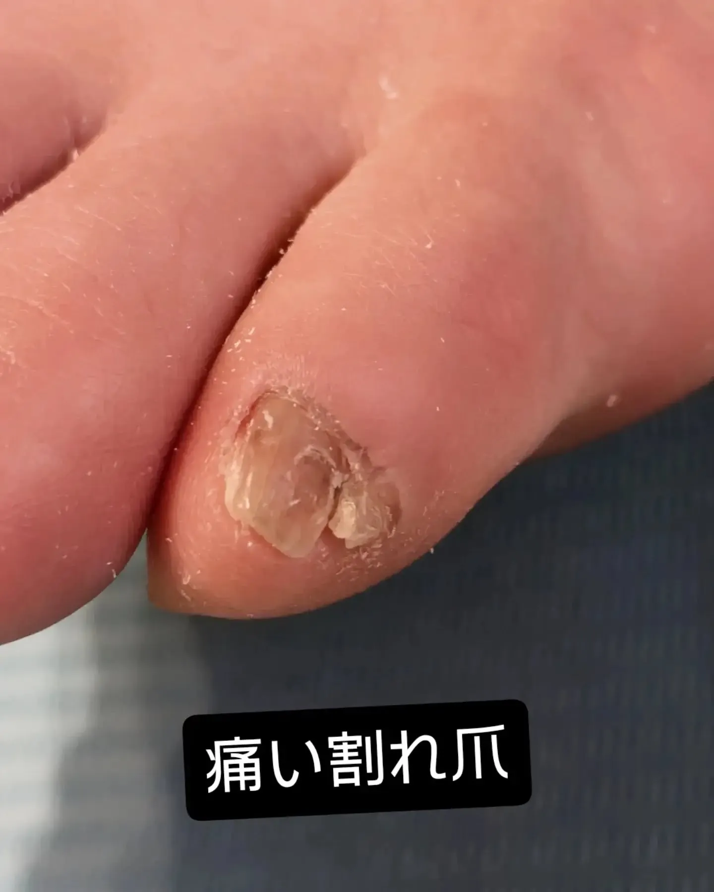 夏は素足になりたい季節ですが🫢ちゃんとケアしてますか？セルフ...